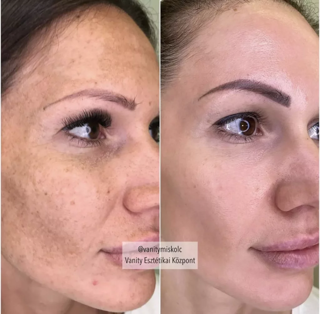 Vanity Esztétikai Központ