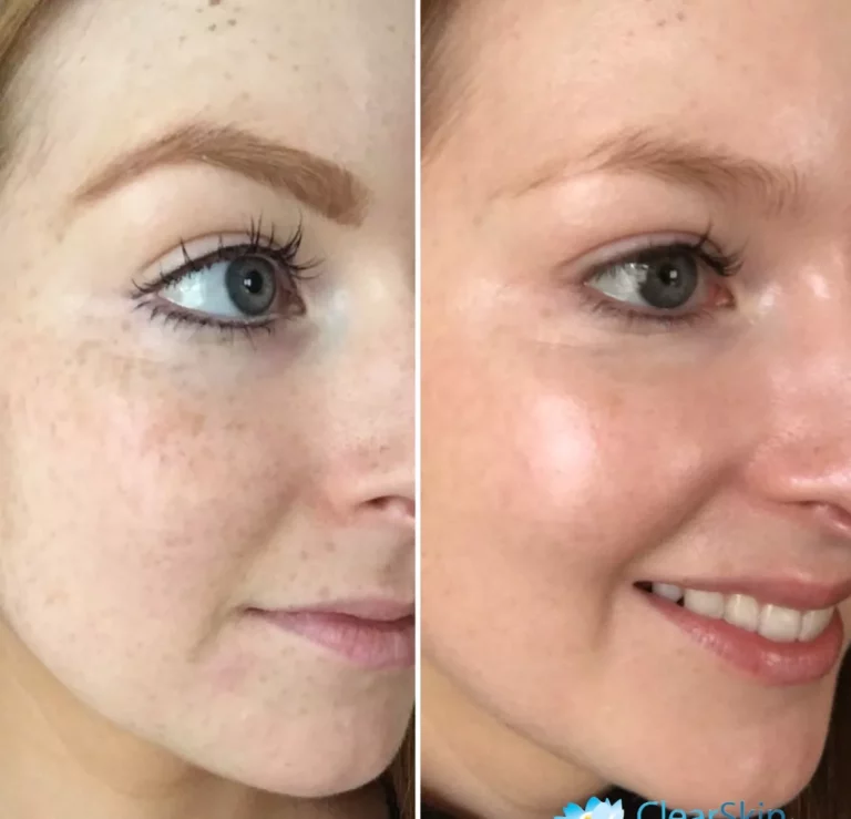 Zo Skin Health bőrápolás